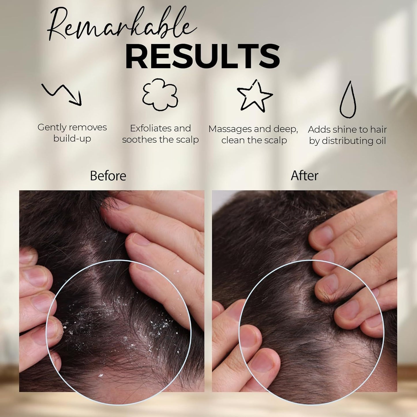 Silicon Scalp Massager Shampoo Brush Scrubber