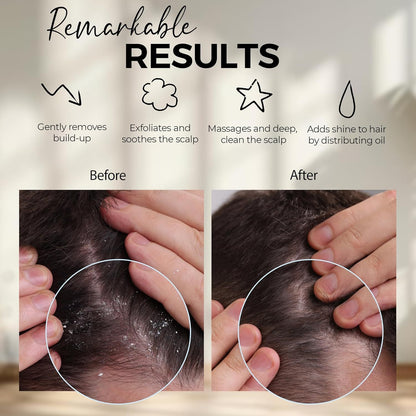 Silicon Scalp Massager Shampoo Brush Scrubber